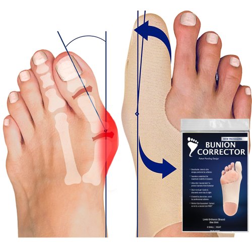 Bunion Bootie - Bunion Corrector for Women - Effective, Ultra-Thin Big Toe Straightener for Day & Night Comfort, Wearable with Shoes, Comfortable Bunion Socks for Correction - Med-Left
