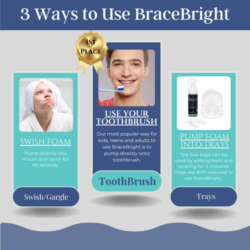 Teeth Whitening for Braces Cleaner kit Under Metal, Ceramic, Clear Brackets & Wires. Use w/Toothbrush, Rinse or in Trays. No Sensitivity. Fights Plaque, Minty Foam, Kid Friendly, Tooth Stain Remover