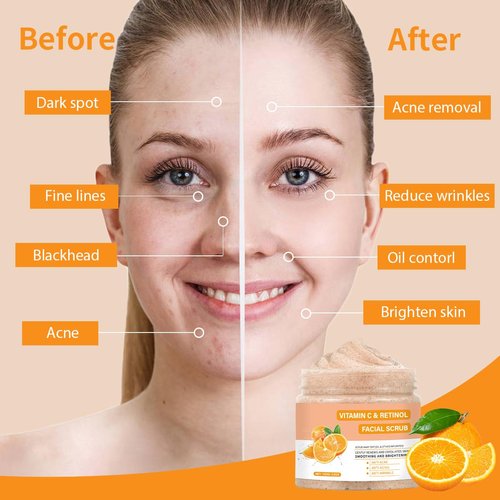 Vitamin C Face Scrub, Exfoliating Facial Wash with Retinol, Face Scrub,Facial Exfoliating Scrub, Facial Scrubs for Women,Deep Cleansing Face Wash Cleanser for Women Men