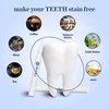 Cheeky LED Teeth Whitening Kit with Whitener Gel and Mouthpiece, DIY Home System to Diminish Stains and Discoloration, Dental and Enamel Safe