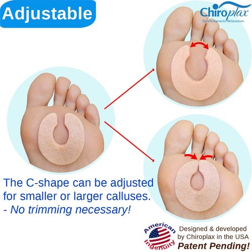 Chiroplax C-Shaped Felt Callus Cushion Pads Protector Rubbing Pain Relief Forefoot Metatarsal | 3/16" Thick (Pack of 30)