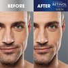 Retinol Men’s Eye Cream – The Original Retinol Eye Treatment For Men – Targets Under-Eye Area to Reduce Puffiness & Dark Circles, Boost Hydration & Drastically Minimize the Visible Signs Of Aging