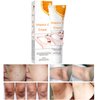Dark Spot Remover for Intimate Area and Inner Thighs, Vitamin C Skin Cream, Dark Spot Corrector for Body, Armpit, Underarm, Knees, Elbow, Neck, Private Areas and Bikini Line, 1.77Oz (1 PCS)