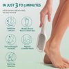Gorgellux Callus Remover for Feet, Callus Remover Gel & Foot File Kit, Foot Callus Remover Gel Set for Dead Skin, Salon Pedicure Spa Kit, Callus Remover for Feet Gel