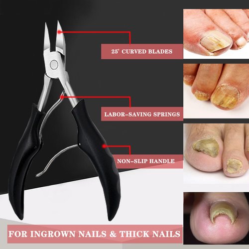Ingrown Toenail Clippers Removal Kit Pedicure Tools for Feet Pedicure Knife Nail Pliers Treatment Cuticle Cutter