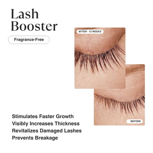 MATKAS Korean Gentle Lash Serum for Eyelash Growth - Eyelash Serum To Grow Lashes Stronger, Thicker, Healthier Eye Lash, Eyelash Growth Serum - Panthenol, Niacinamide, Amino Acids, Vitamin E, Peptides
