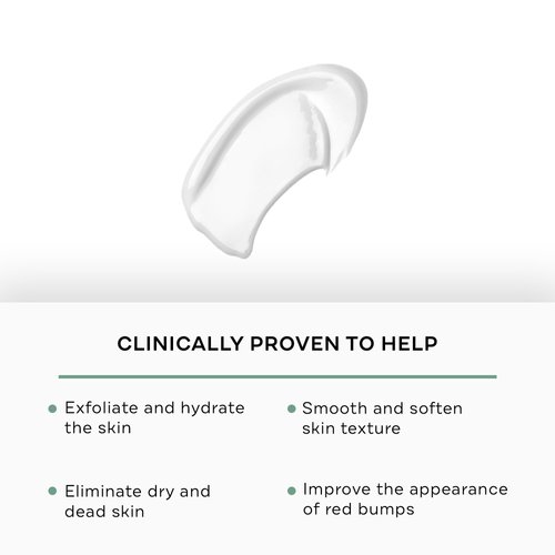 Replenix Glycolic Acid 15% Resurfacing Body Lotion, Medical-Grade Brightening & Hydrating Exfoliating Cream for Skin Discoloration & Rough Texture (6.7 fl. oz)