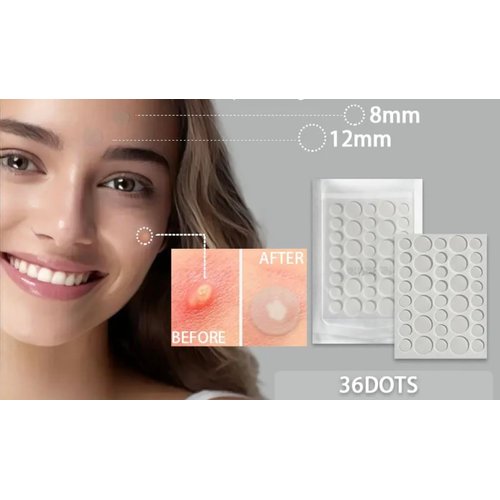 Acne Patch Invisible 100%-Hydrocolloid for Covering Blemishes,Zits Absorbing Patch, Breakouts Spots Treatments for skin 4-8 hs Results 36 Counts 2 Sizes