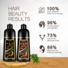 Onilyua Instant Dark Coffee Hair Dye Shampoo for Men & Women, Brown Hair Dye, 3 in 1 Hair Dye Shampoo 16.9 floz, Natural Shampoo Para Canas, Gray Hair Coverage for Home Use (Dark coffee)