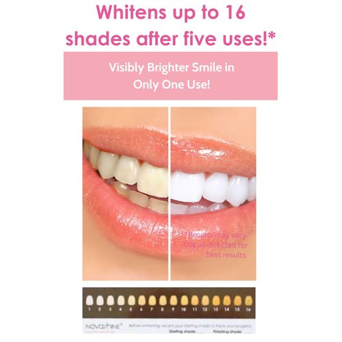 Novashine Professional Teeth Whitening Kit: Advanced Blue LED Light, Concentrated Peroxide Gel, Smartphone Adapter, Travel Bag