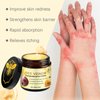 Bee Venom Comprehensive Cream, Bee Venom Skin Treatment Cream, All-in-One, Lifting & Firming, Anti-Aging Moisturizing, Effectively reduces all types of skin blemishes