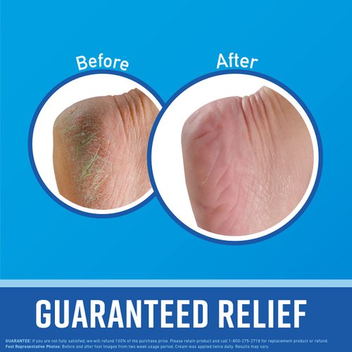 O'Keeffe's for Healthy Feet Foot Cream; Guaranteed Relief for Extremely Dry; Cracked Feet; Clinically Proven to Instantly Boost Moisture Levels; 3.0 Ounce Tube; (Pack of 1)