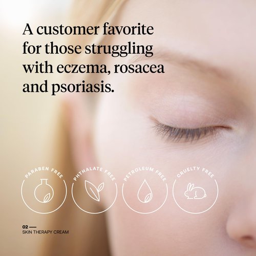 FIRST HONEY® Manuka Honey Cream for Dry & Itchy Skin | Fast Relief for Eczema, Rosacea, Psoriasis, & Dermatitis | Natural & No Fillers | Safe for Babies & Toddlers | 3.5 oz