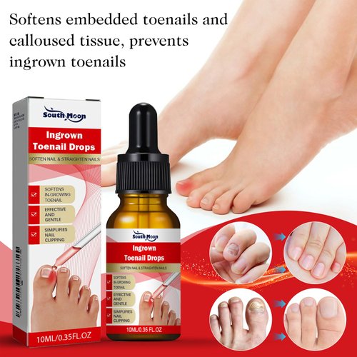 2PCS Ingrown toenail drops,Ingrown Toenail Relief,Easy Trim Ingrown Toenail Tools,Toenail Fluid With Silicone Gel Toe Caps Essential Oil Diffuser,Ingrown Toenail Reliever and Softener Kit