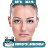Advanced Retinol Collagen Cream for Face with 5% Hyaluronic Acid Anti-Aging Cream Anti-Wrinkle Reduce Fine Lines Lifting and Firming Cream 24-Hour Facial Care Suitable For All Skin Types
