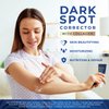 Dark Spot Remover for Face and Body: Corrector for Age Spots Sun Spots Freckles Melasma Brown Spots - Niacinamide Vitamin C Formula for Women and Men - Use on Face Hands Underarms and Legs 2 Oz