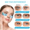 Under Eye Patches for Puffy Eyes - 24 Pairs Retinol Collagen Eye Gel Pads, Reduce Wrinkles, Puffy Eyes, Eye Bags - Eye Mask Skincare, Anti Aging & Face Moisturizer