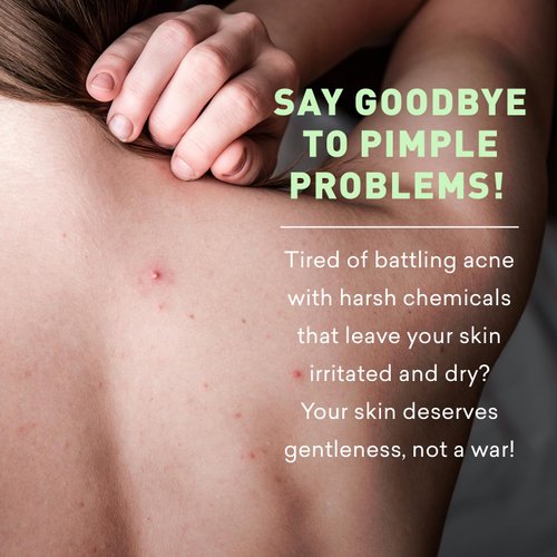 Just Nutritive Acne Clear Face and Body Wash | Adult Acne Treatment | Acne Face Wash | Face Skin Care | Back Acne Treatment | Acne Cleansers 16 Oz