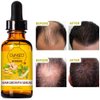 5 PACK Hair Growth Serum Liquid Hair Loss Treatment for Women & Men Dense Thicken Hair