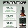 Actora Thyroid Support Drops with Selenium Zinc Iodine L-Tyrosine Ashwagandha Energy Supplement - 4 fl oz (1pcs)