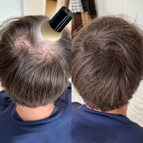 KERATIN RESEARCH Hairline Filler Unisex Mineral Powder Root Touch-Up Hair loss Concealer Scalp & Beard Bald Patch Coverage Fibers for Thinning Hair Waterproof Organic Natural look (MEDIUM BROWN, XL)