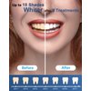MySmile Teeth Whitening Gel Pen Refill Pack, 3 Non-Sensitive Teeth Whitening Pen, Deluxe Teeth Whitener Dental Grade Tooth Whitening Gel with Carbamide Peroxide for Home, 10 min Fast Result
