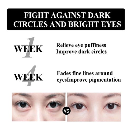 gcdat Firming Eye Cream, Snake Venom Peptide Eye Cream, Daily Anti-Aging Under Eye Cream, Remove Pouches Dark Circles Anti-Wrinkle Diminishing Eye Lines Lifting Firming