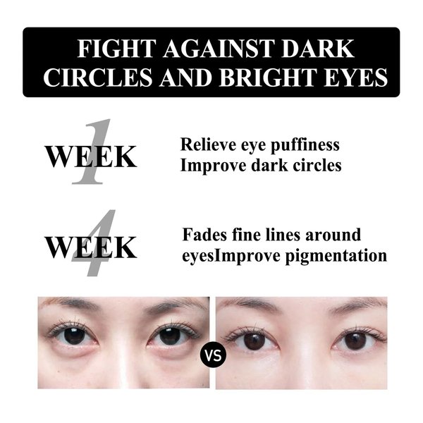 gcdat Firming Eye Cream, Snake Venom Peptide Eye Cream, Daily Anti-Aging Under Eye Cream, Remove Pouches Dark Circles Anti-Wrinkle Diminishing Eye Lines Lifting Firming