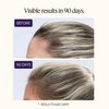 OMI WellBeauty Women's Hair Growth Peptides Capsules, Doctor Recommended, Patented Follicle Fortifying Biotechnology, Clinically Shown to Reduce Hair Loss, 1-Month Supply