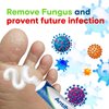 CHARMPOO Antifungal Cream for Foot and Body: Fast Relief Athlete's Foot Jock Itch Psoriasis Ringworm Eczema Rashes - Powerful Herbal and Miconazole Formula 30g(Pack of 1)