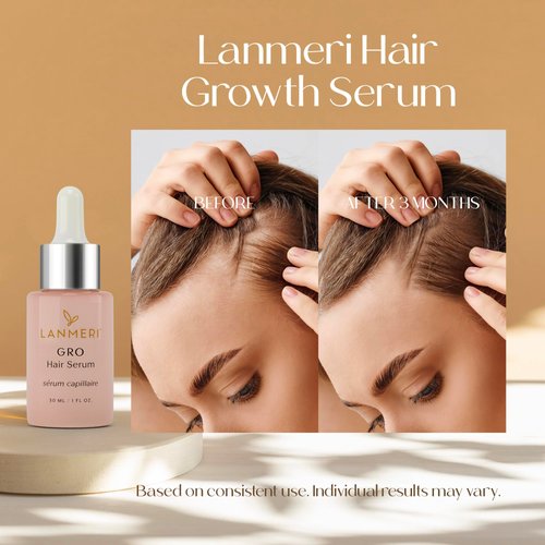 Lanmeri Vegan Hair Growth Serum for Women & Men - Natural Scalp Treatment for Thinning Hair and Hair Regrowth - Fuller-looking, Thicker and Healthier Hair in 90 Days, All Hair Types