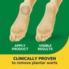 Dr. Scholl's Clear Away Plantar WART Remover // 24 Discs/24 Cushions, Clinically Proven, Maximum Strength Without a Prescription, Cushioning Pad Relieves Pain, 24 Treatments
