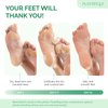 PLANTIFIQUE Foot Peel Mask with Peach 1 Pack Peeling Foot Mask Dermatologically Tested - Repairs Heels & Removes Dry Dead Skin for Baby Soft Feet - Exfoliating Mask for Dry Cracked Feet