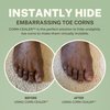 CORN-CEALER | Toe Makeup That Instantly Hides Toe Corns | Water Resistant | Foot Care | Body Makeup | Scar Makeup | Tattoo Cover up | (Shade MOCHA)