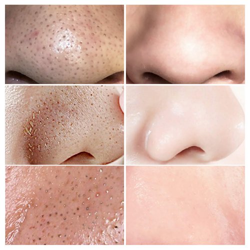 LANBENA Blackhead Remover Mask, Blackhead Remover Mask Peel Off Blackhead Mask 2 in 1 Green Tea Oil Blackhead Removal 100 Pcs Blackhead Remover Mask for Pores, Nose, Chins & Face